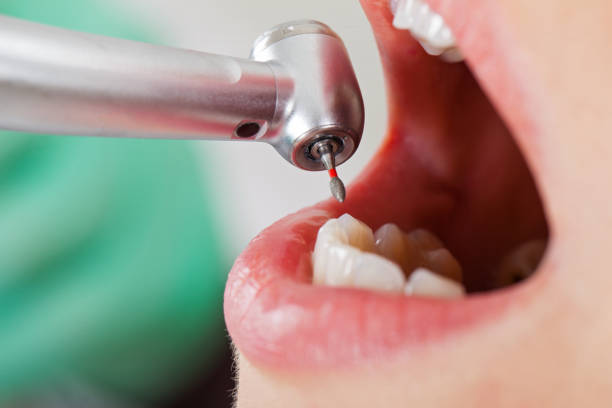 Best Emergency Dental Care for Broken or Chipped Teeth in Margaret, AL
